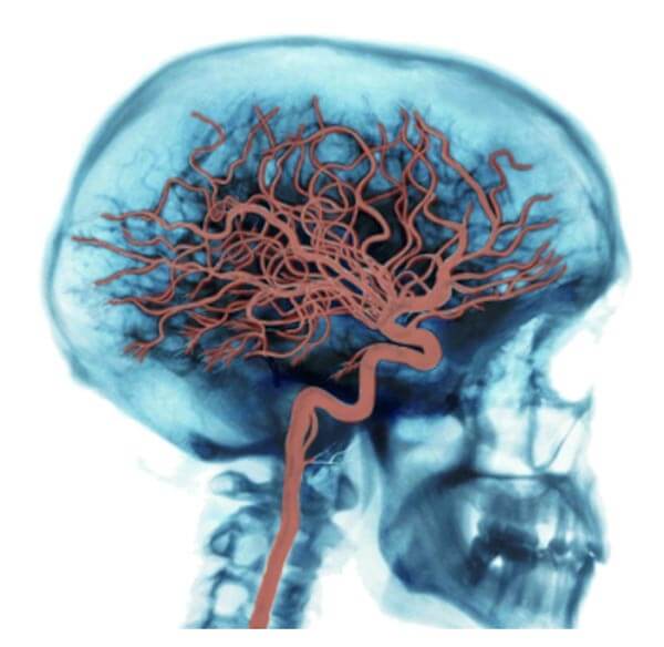 Brain Arteries